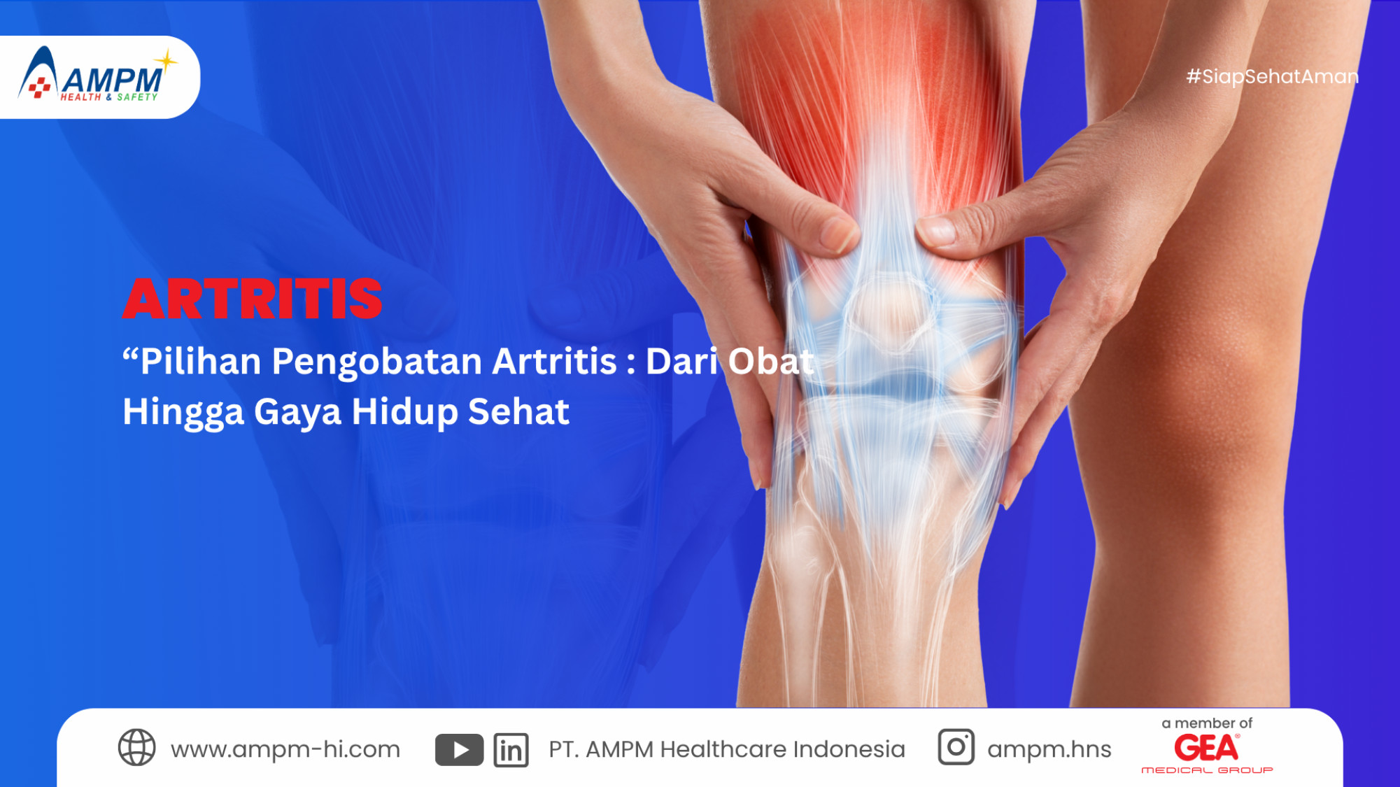 Pilihan Pengobatan Artritis : Dari Obat Hingga Gaya Hidup Sehat
