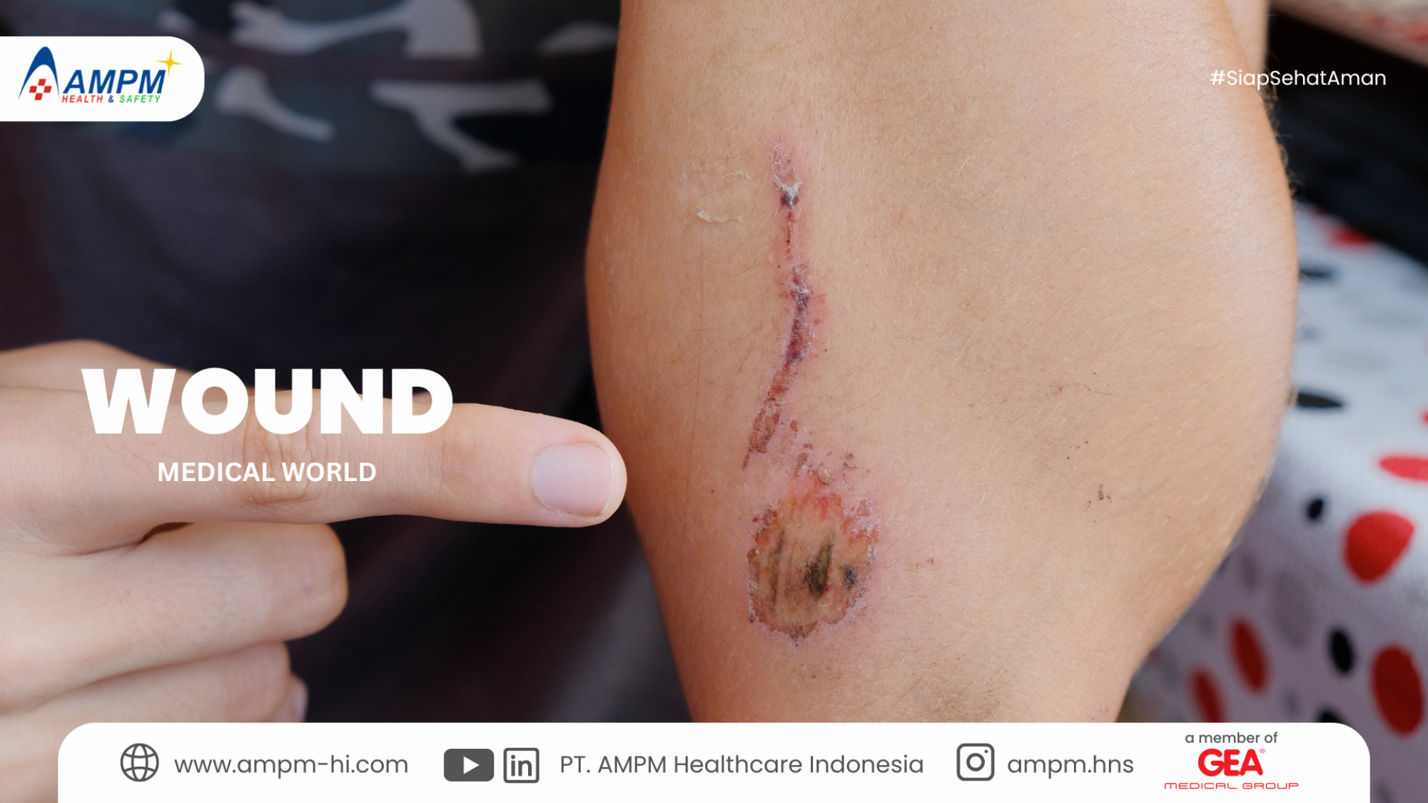 Wound (Luka)
