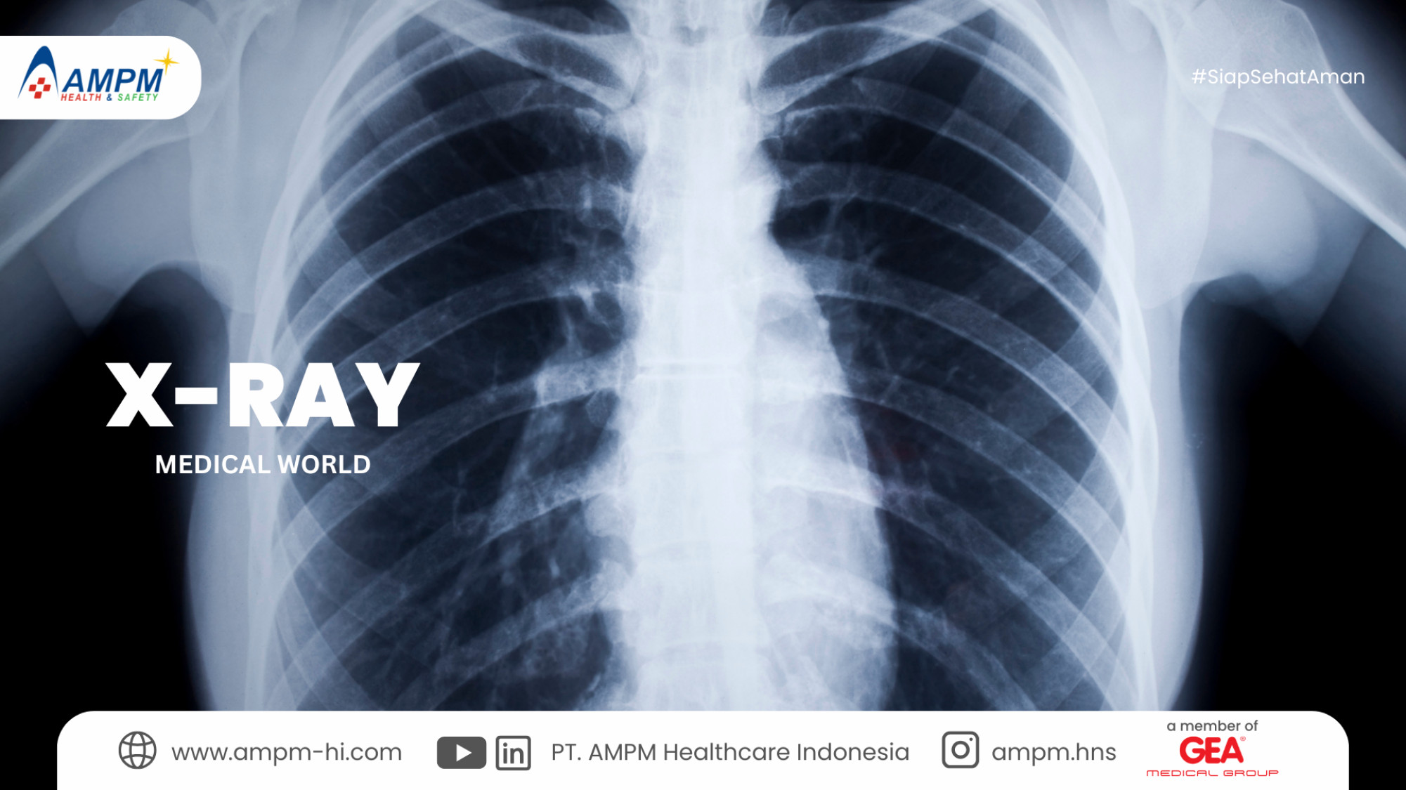 X-ray