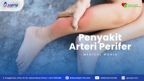 Penyakit Arteri Perifer (PAD)