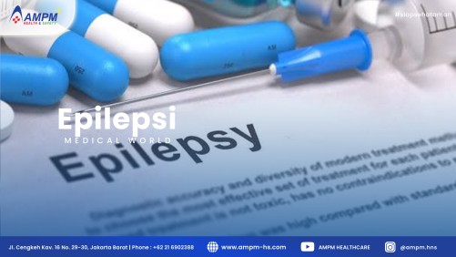 Epilepsi