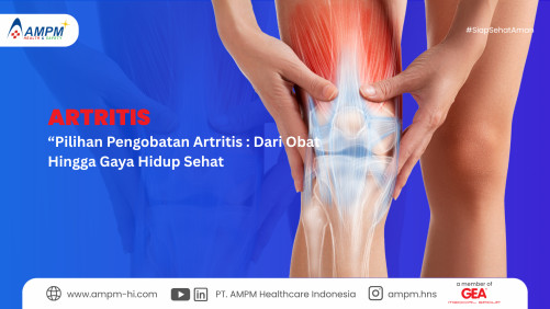 Pilihan Pengobatan Artritis : Dari Obat Hingga Gaya Hidup Sehat