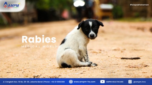 Rabies