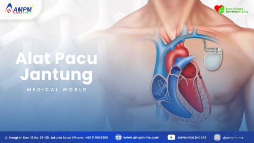 Alat Pacu Jantung (ICD)