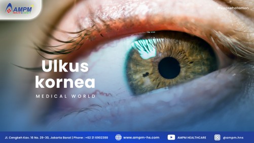 Ulkus kornea