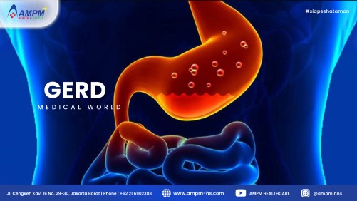 Gerd ( Gastroesophageal Reflux Disease )
